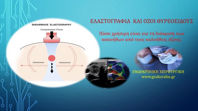 Ελαστογραφία και όζος θυρεοειδούς - διάκριση καλοήθους από κακοήθη όζο