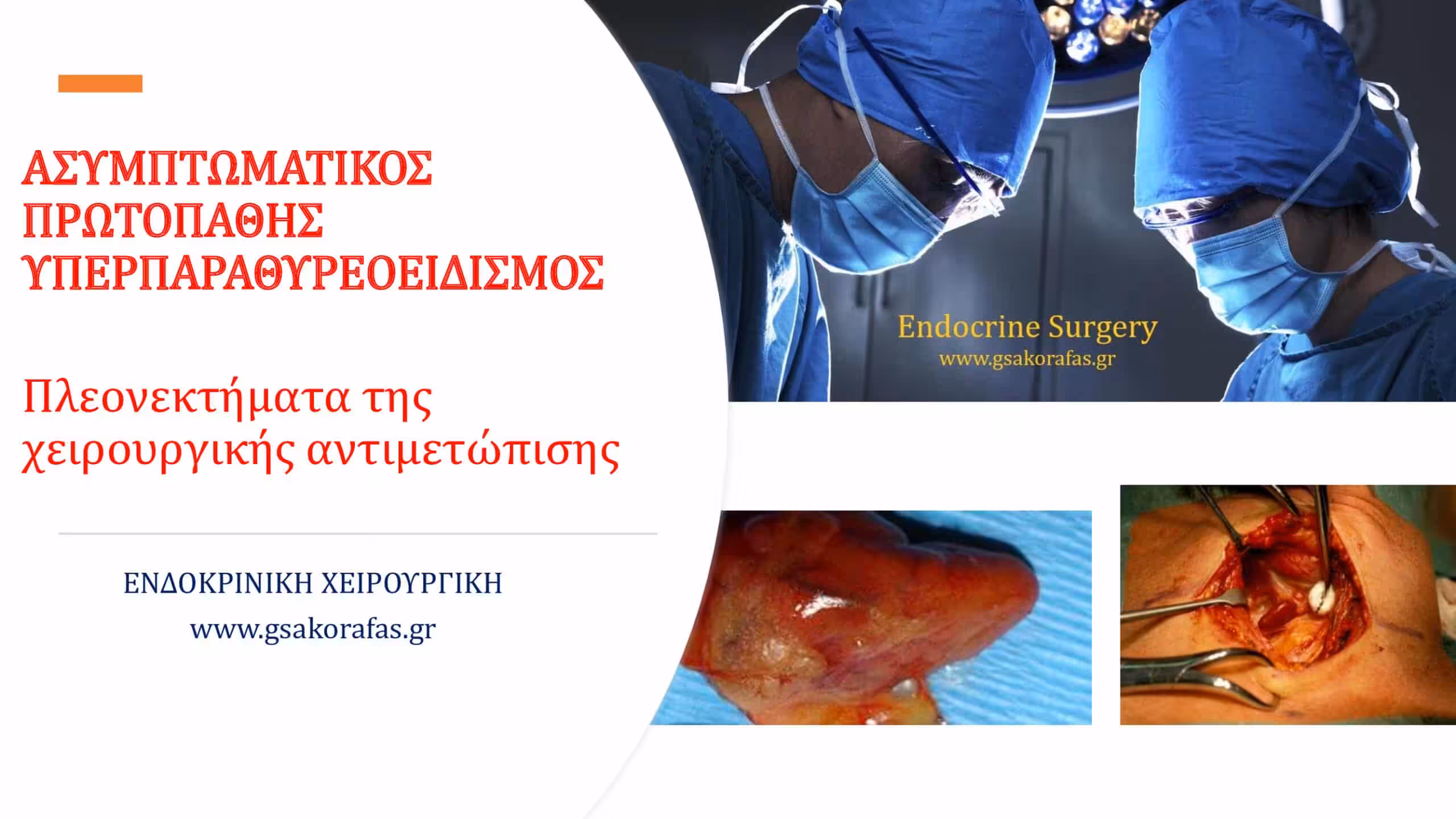 Ασυμπτωματικός Υπερπαραθυρεοειδισμός – Πλεονεκτήματα της Χειρουργικής Αντιμετώπισης