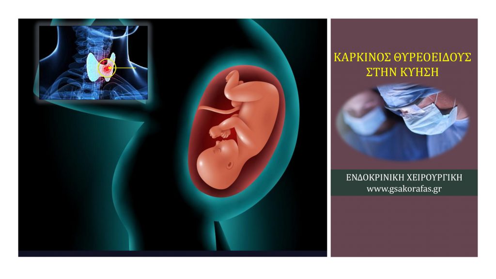 Καρκίνος θυρεοειδούς και εγκυμοσύνη