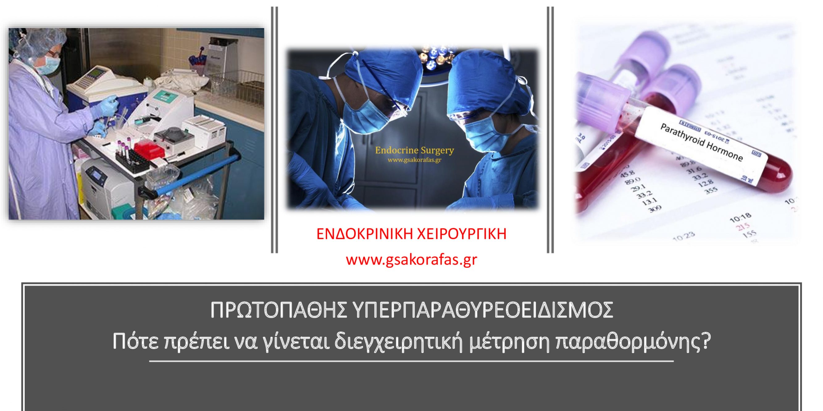 Πρωτοπαθής υπερπαραθυρεοειδισμός και διεγχειρητική μέτρηση παραθορμόνης ορού - ενδείξεις