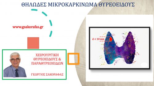 Θηλώδες μικροκαρκίνωμα θυρεοειδούς