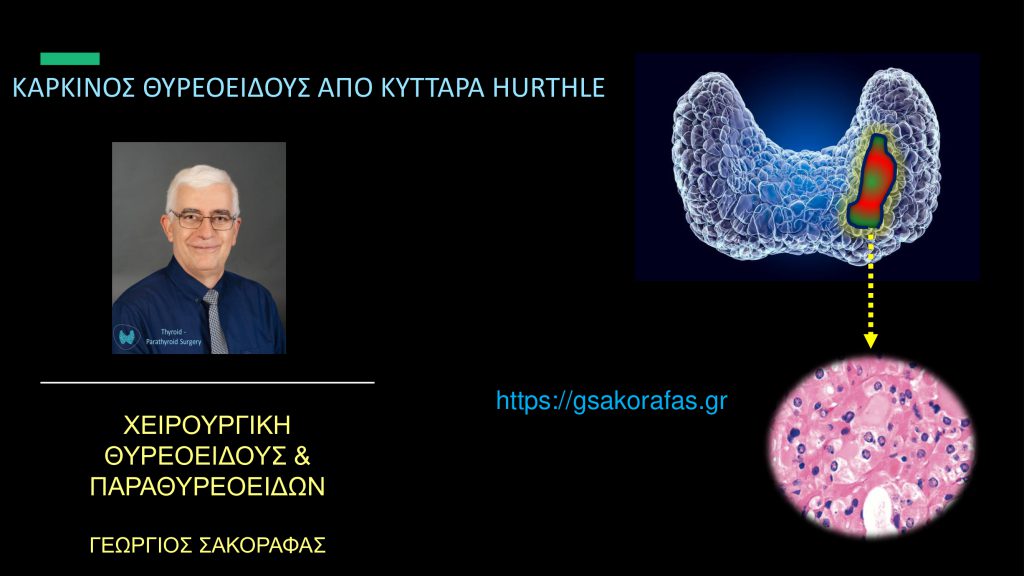 Hürthle-cell καρκίνος θυρεοειδούς
