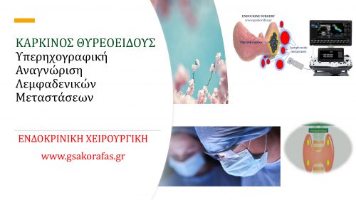 Καρκίνος θυρεοειδούς και υπερηχογράφημα - λεμφαδενικές μεταστάσεις
