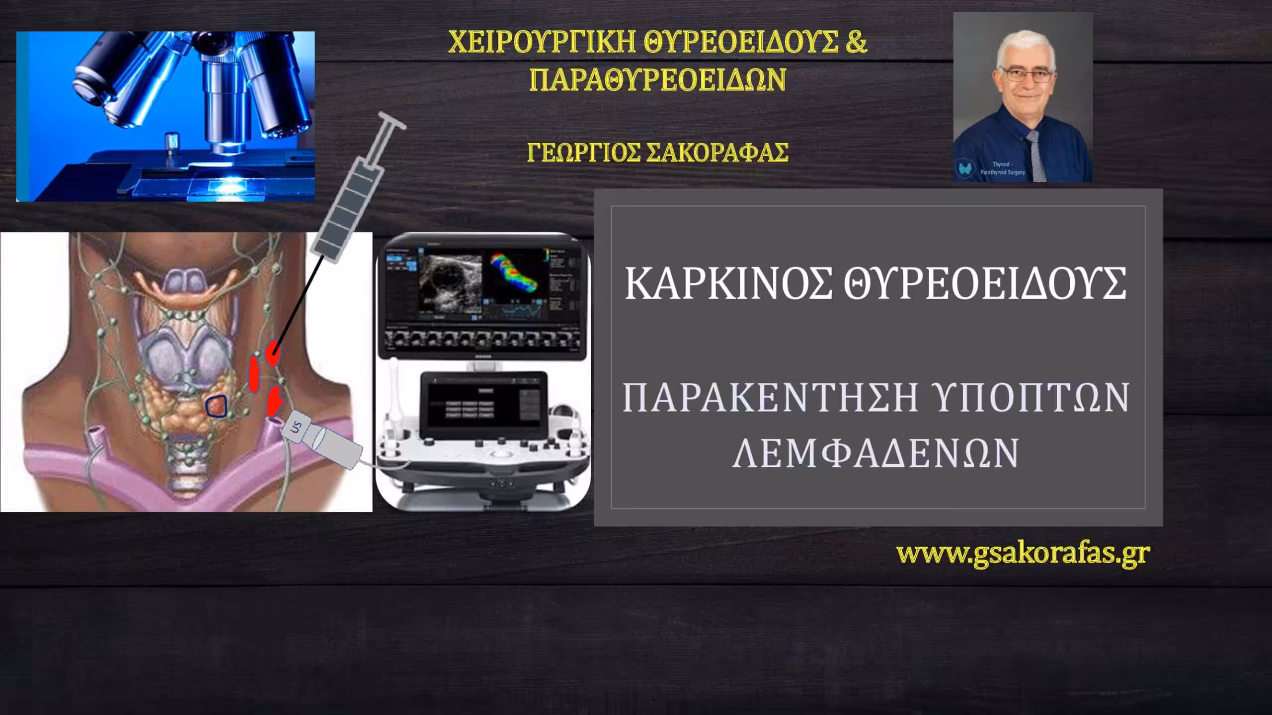 Καρκίνος θυρεοειδούς και λεμφαδενικές μεταστάσεις: παρακέντηση ύποπτων λεμφαδένων