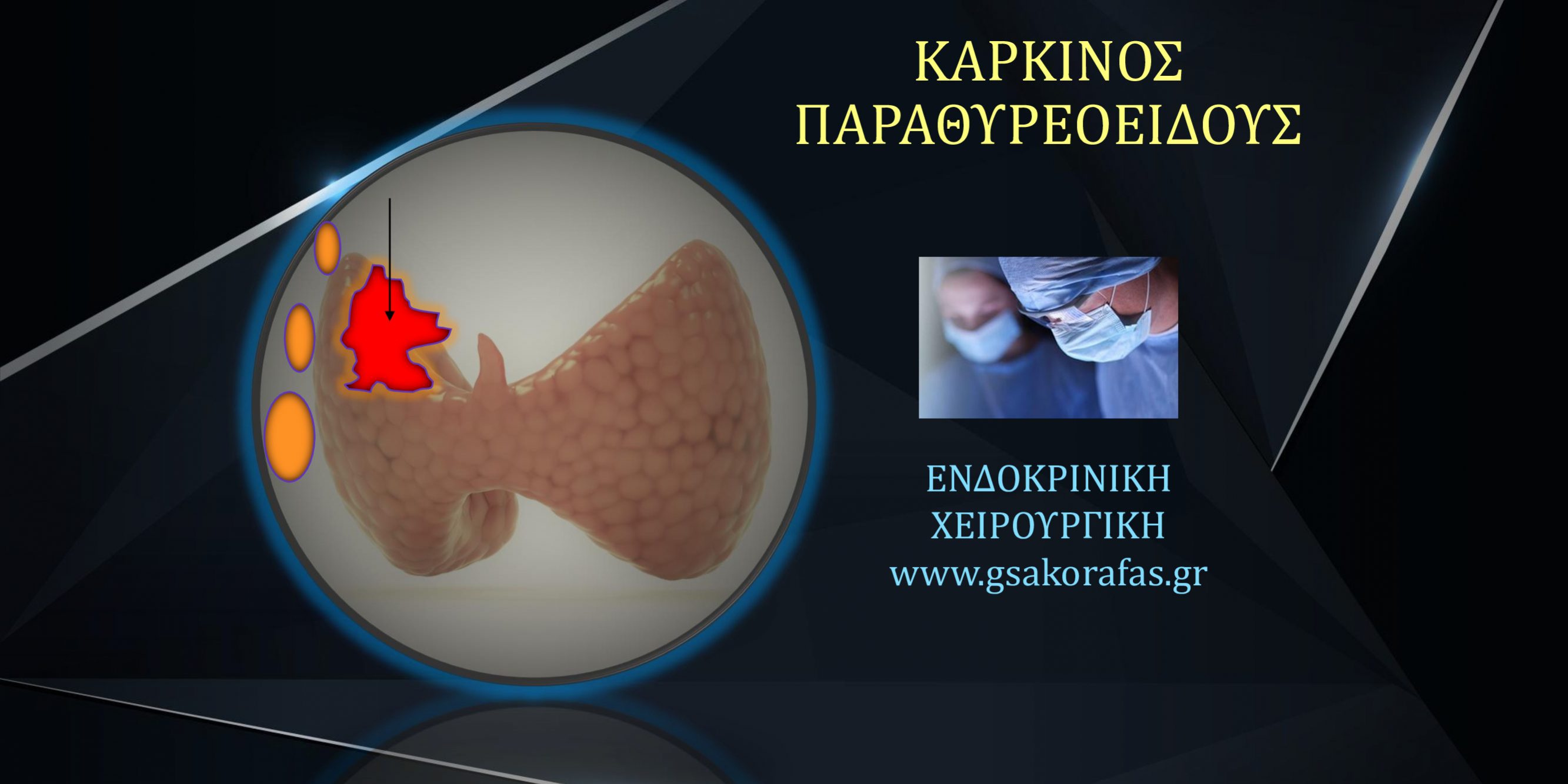 Καρκίνος παραθυρεοειδούς και προεγχειρητική διάγνωση