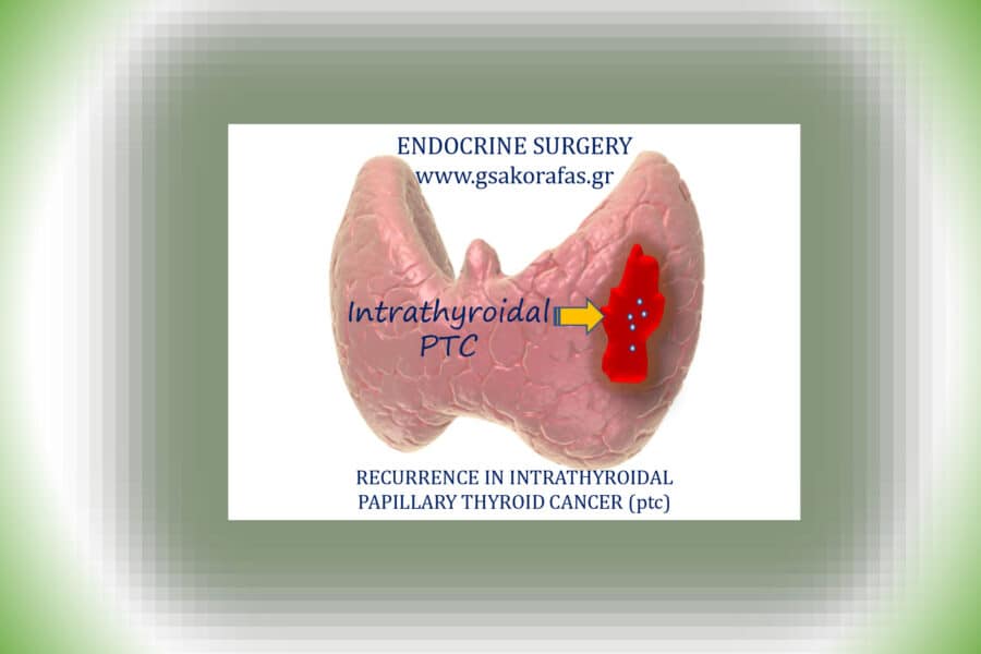Ενδοθυρεοειδικός θηλώδης καρκίνος θυρεοειδούς και πιθανότητα υποτροπής