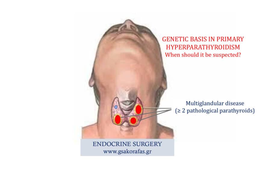 Πρωτοπαθής υπερπαραθυρεοειδισμός και κληρονομικότητα