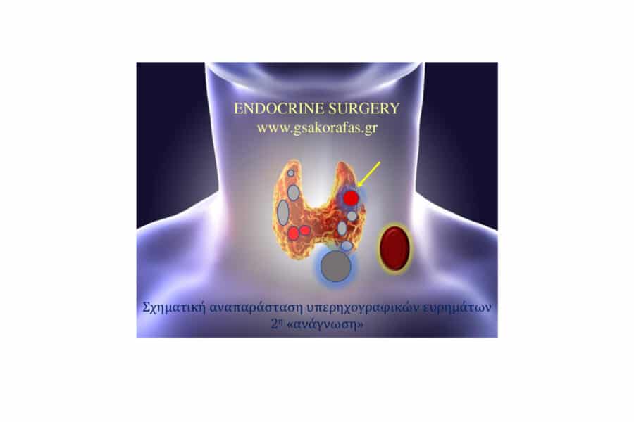 Υπερηχογράφημα και καρκίνος θυρεοειδούς - δύο διαφορετικές αναγνώσεις