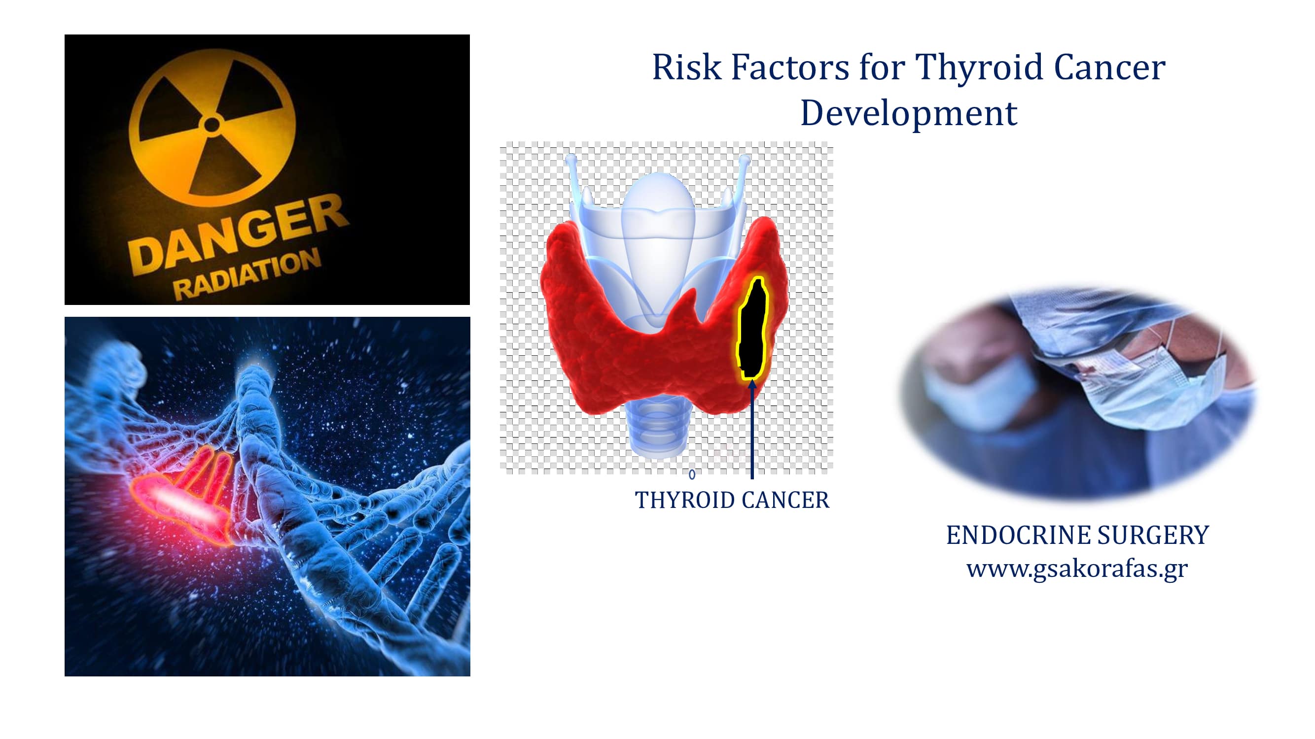 Thyroid cancer – Risk factors
