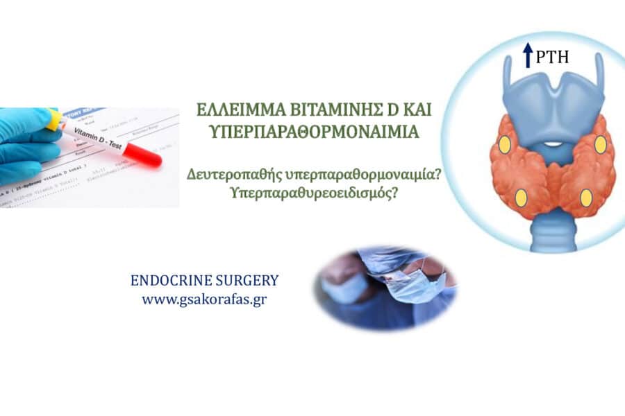 Πρωτοπαθής υπερπαραθυρεοειδισμός και βιταμίνη D - η σημασία της αξιολόγησης των επιπέδων της
