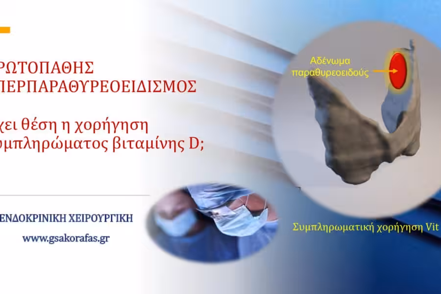 Πρωτοπαθής υπερπαραθυρεοειδισμός και βιταμίνη D- έχει θέση η συμπληρωματική χορήγησή της;