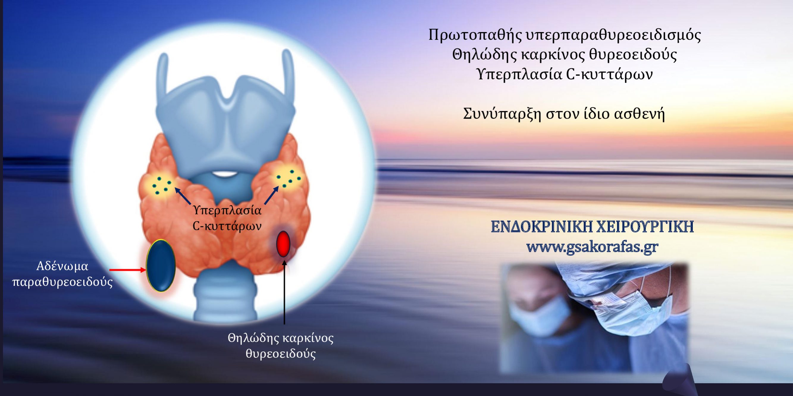 Υπερπαραθυρεοειδισμός (αδένωμα παραθυρεοειδούς), υπερπλασία C-κυττάρων, θηλώδης καρκίνος θυρεοειδούς-συνύπαρξη στον ίδιον ασθενή