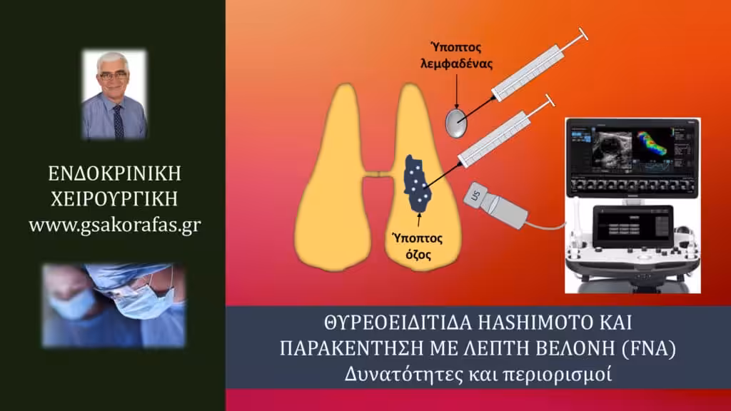 Θυρεοειδίτιδα Hashimoto Και Παρακέντηση Με Λεπτή Βελόνη (Fna) – Σημασία Στην Πράξη Και Περιορισμοί Θυρεοειδίτιδα Hashimoto Και Παρακέντηση Με Λεπτή Βελόνη (Fna) – Σημασία Στην Πράξη Και Περιορισμοί