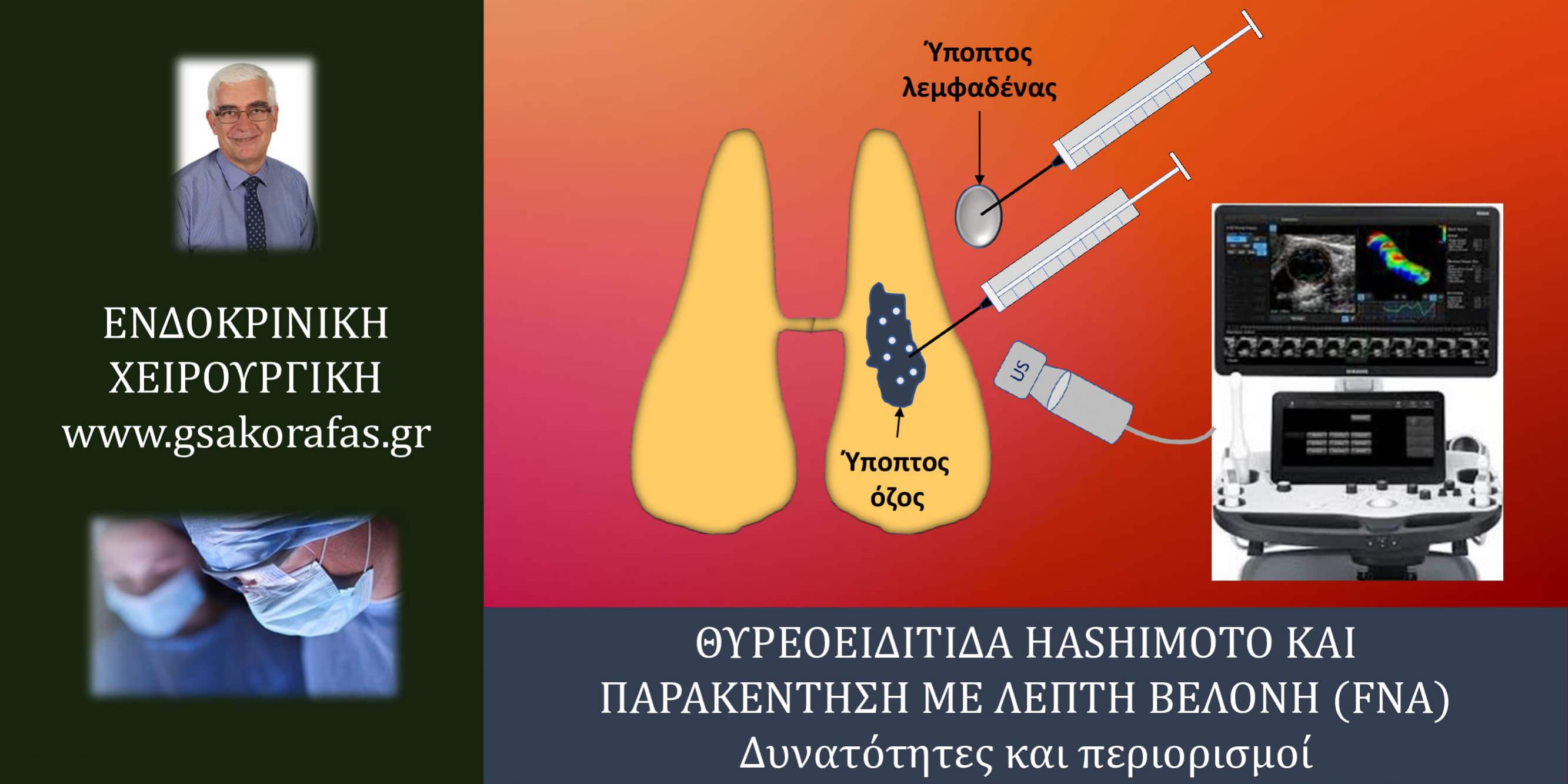 Θυρεοειδίτιδα Hashimoto και παρακέντηση με λεπτή βελόνη (FNA) – σημασία στην πράξη και περιορισμοί