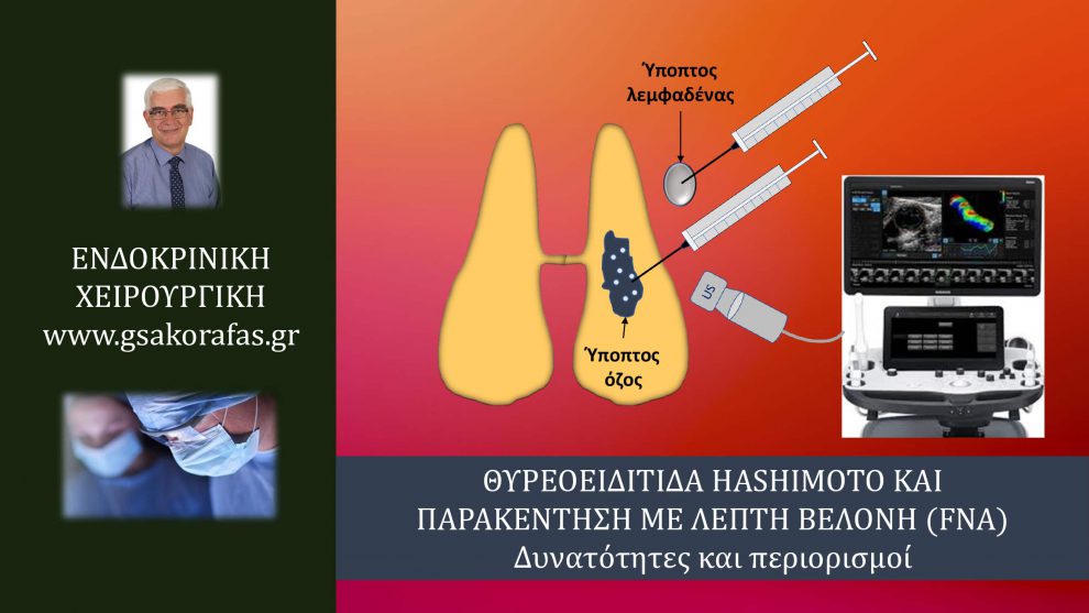 Θυρεοειδίτιδα Hashimoto και παρακέντηση με λεπτή βελόνη (FNA) – σημασία στην πράξη και περιορισμοί