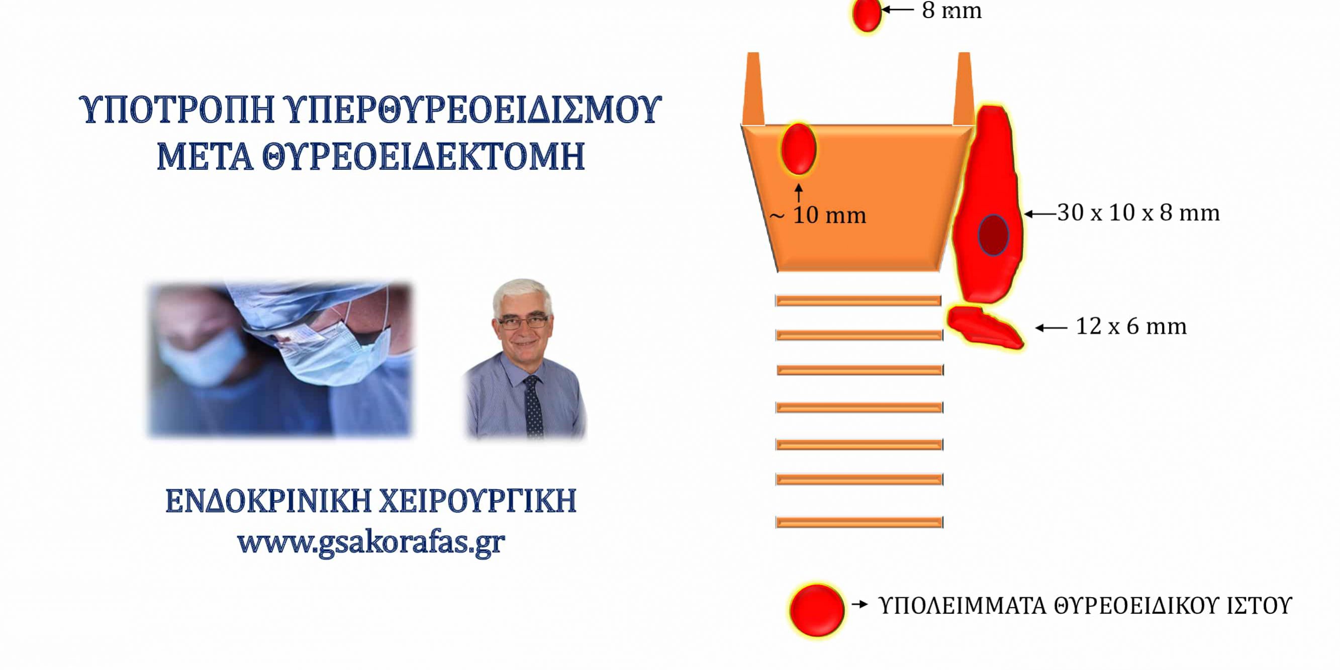 Υπερθυρεοειδισμός (νόσος Graves’) και θυρεοειδεκτομή - η σημασία της έκτασης της θυρεοειδεκτομής