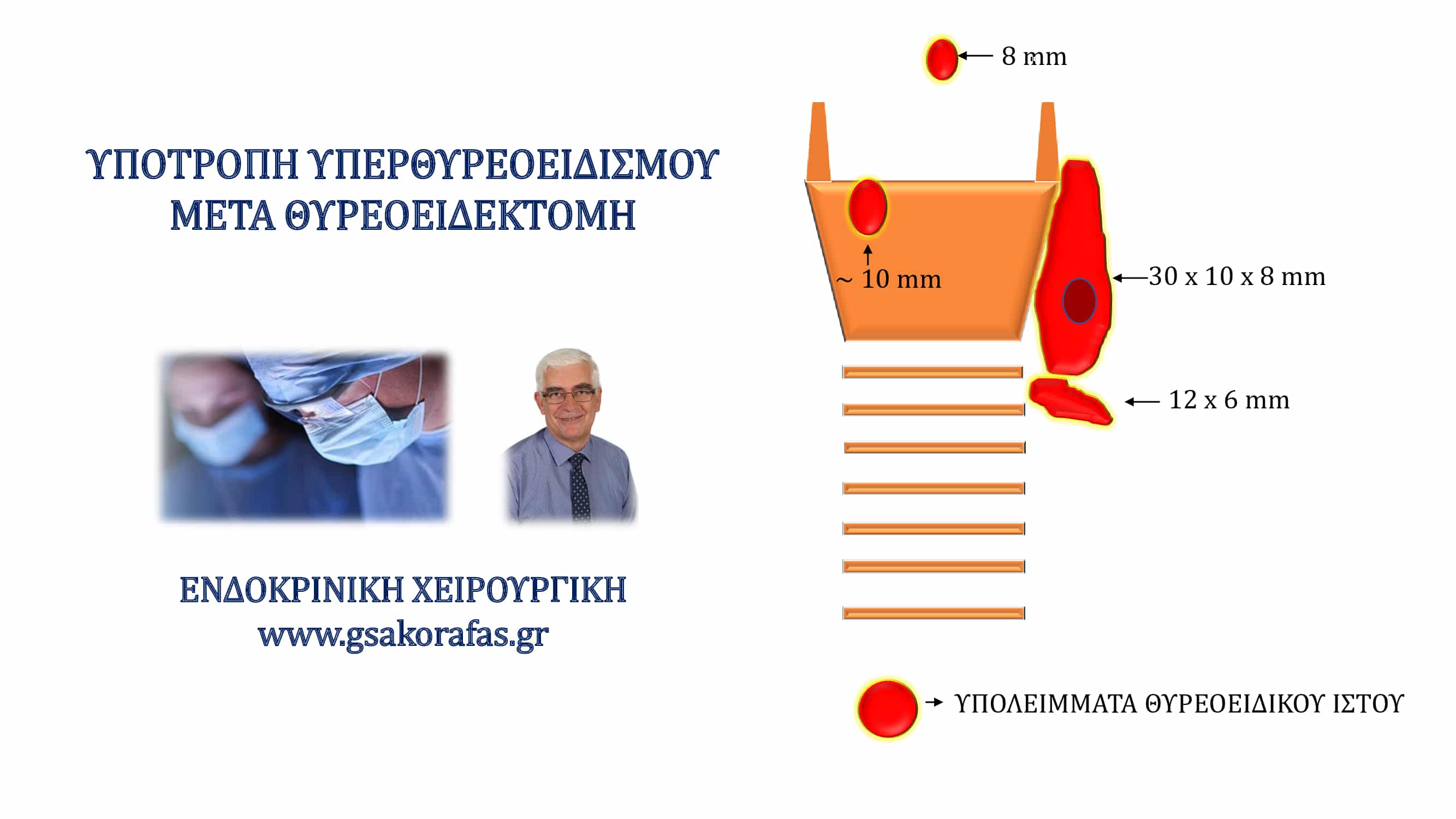 Υπερθυρεοειδισμός (νόσος Graves’) και θυρεοειδεκτομή – η σημασία της έκτασης της θυρεοειδεκτομής (με αφορμή μία ασθενή μας)