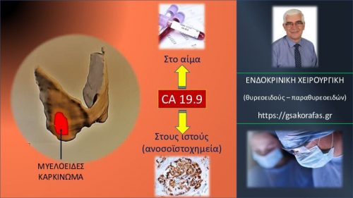 Μυελοειδές καρκίνωμα θυρεοειδούς και CA19.9- o ρόλος του σαν καρκινικός [νεοπλασματικός] δείκτης