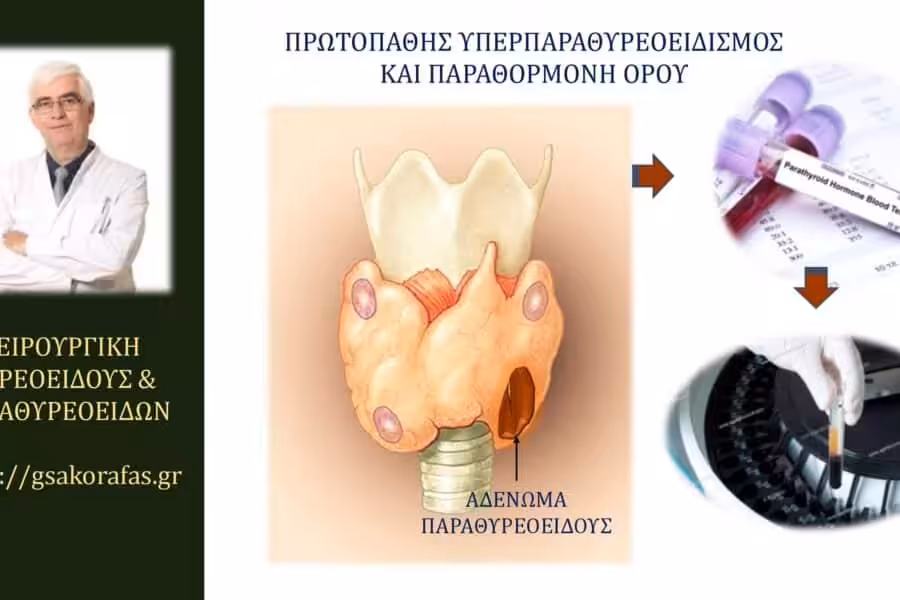 Υπερπαραθυρεοειδισμός-παραθορμόνη ορού