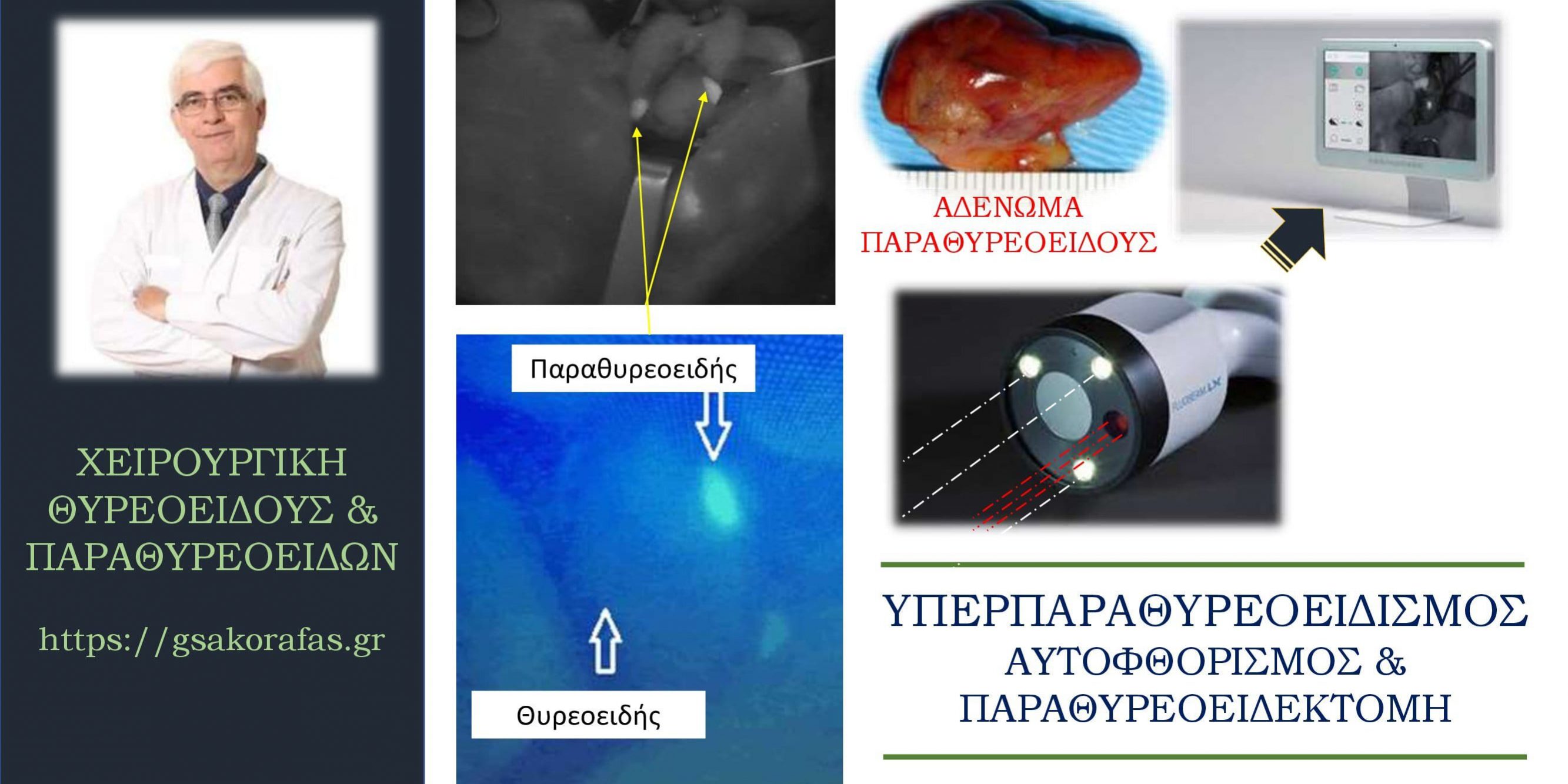 Υπερπαραθυρεοειδισμός και αυτοφθορισμός – μία νέα τεχνική στην παραθυρεοειδεκτομή