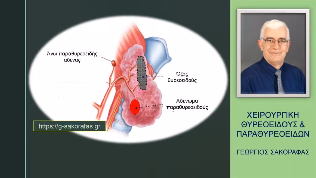 Θυρεοειδεκτομή-Παραθυρεοειδεκτομή Στον Ίδιο Χρόνο (Ταυτόχρονη)