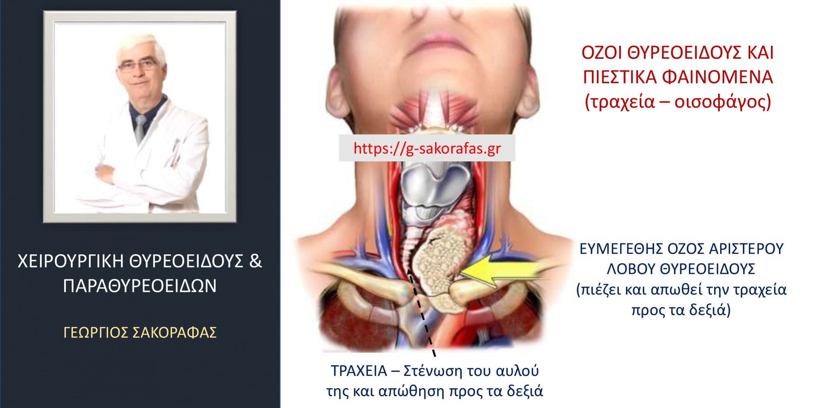 Όζοι θυρεοειδούς και ‘πιεστικά φαινόμενα’ από την τραχεία και τον οισοφάγο