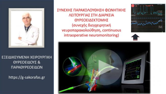 Θυρεοειδεκτομή – συνεχής παρακολούθηση φωνής (φωνητικής λειτουργίας) κατά τη διάρκεια της επέμβασης (συνεχής διεγχειρητική νευροπαρακολούθηση)