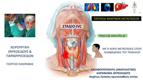 Στάδιο IVC
