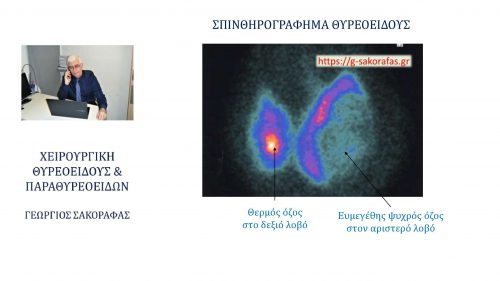 Σπινθηρογράφημα-θερμός και ψυχροί όζοι