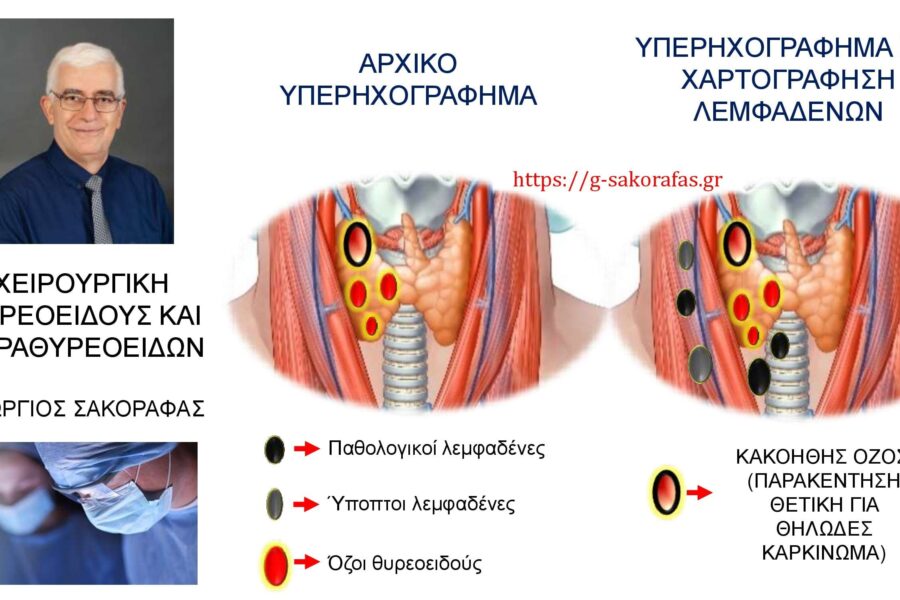 Καρκίνος θυρεοειδούς και χαρτογράφηση λεμφαδένων τραχήλου- Με αφορμή ασθενή μας