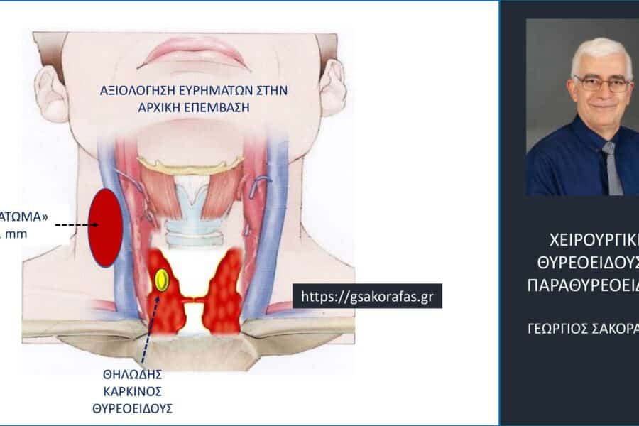 Καρκίνος θυρεοειδούς και θυρεοειδεκτομή – πώς η λάθος διάγνωση μπορεί να οδηγήσει σε λάθος επέμβαση