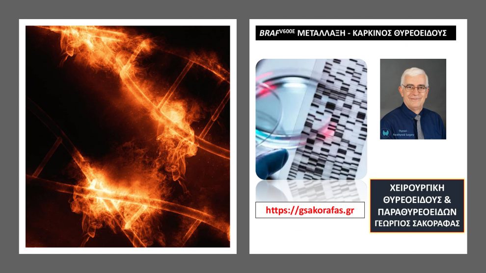 Θηλώδες καρκίνωμα θυρεοειδούς