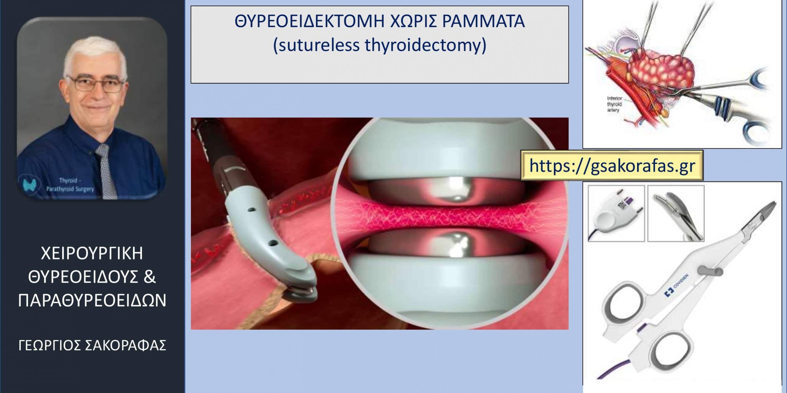 Χωρίς ράμματα θυρεοειδεκτομή (suture-less thyroidectomy)- σημαντικά μειωμένος μετεγχειρητικός πόνος (και κάποια άλλα πλεονεκτήματα)