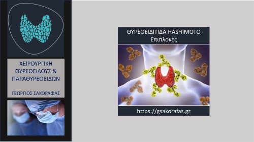 Θυρεοειδίτιδα Hashimoto – τι επιπλοκές μπορεί να προκαλέσει?