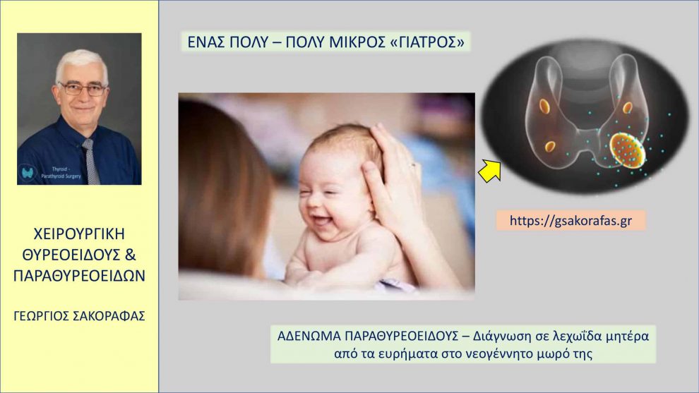 Αδένωμα παραθυρεοειδούς στην εγκυμοσύνη - Ένα πολύ-πολύ μικρός «γιατρός» (νεογνό) :