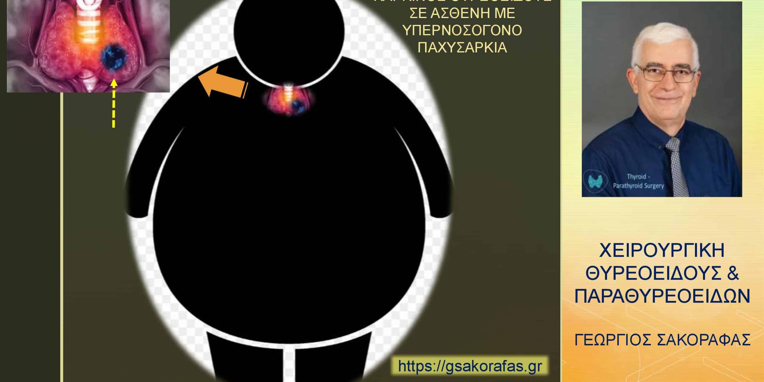 Καρκίνος θυρεοειδούς – θυρεοειδεκτομή σε ασθενή μας με νοσογόνο παχυσαρκία: προβλήματα – ιδιαιτερότητες – πρακτική σημασία