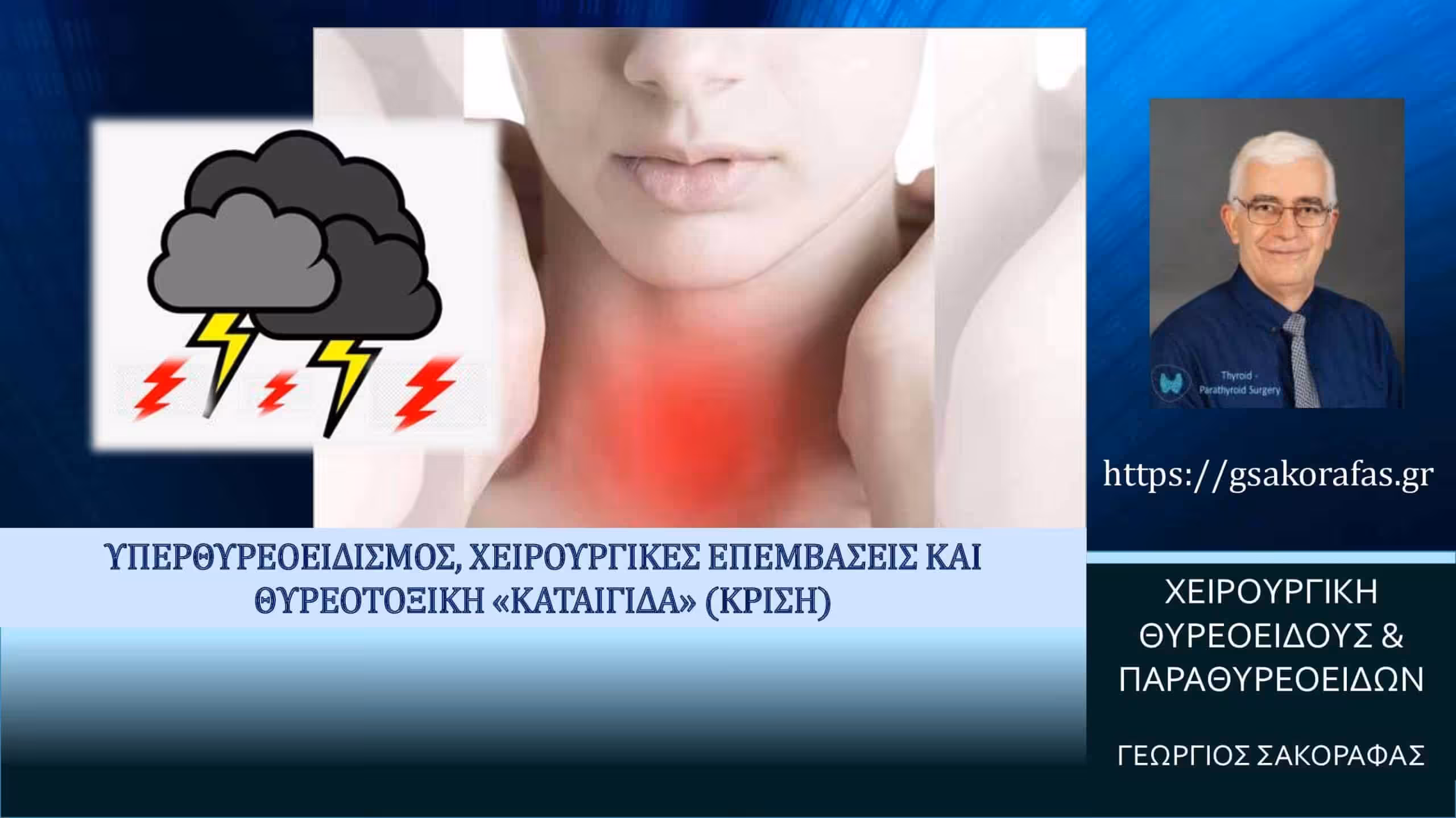 Υπερθυρεοειδισμός, θυρεοτοξική κρίση (‘καταιγίδα’) και χειρουργικές επεμβάσεις