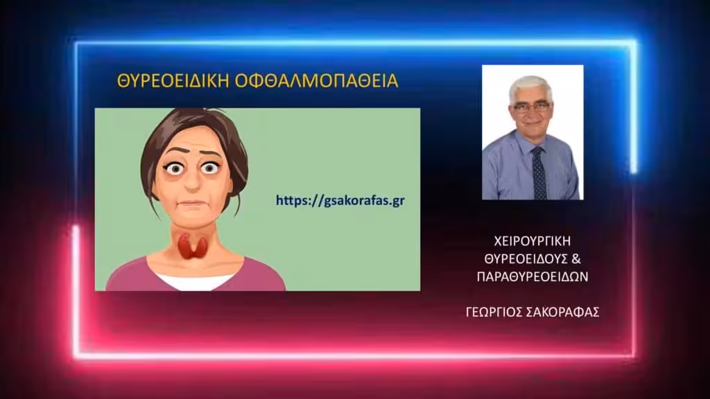 Θυρεοειδική Οφθαλμοπάθεια (Εξόφθαλμος) Και Υπερθυρεοειδισμός Θυρεοειδική Οφθαλμοπάθεια (Εξόφθαλμος) Και Υπερθυρεοειδισμός