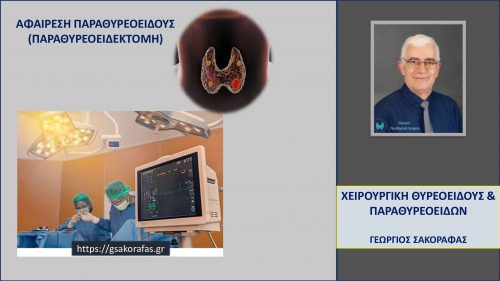 Αφαίρεση παραθυρεοειδούς – παραθυρεοειδεκτομή - πώς γίνεται ? Μέρος Α: προεγχειρητική φάση