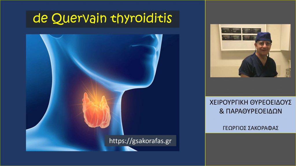 Θυρεοειδίτιδα de Quervain