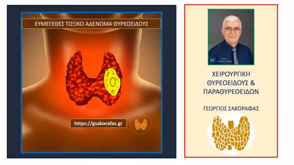 Τοξικό Αδένωμα Θυρεοειδούς