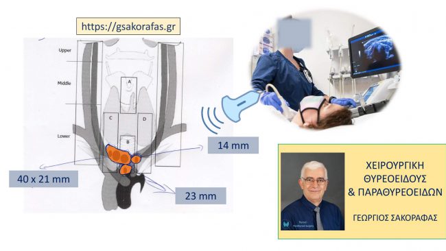 Καρκίνος θυρεοειδούς και θυρεοειδεκτομή-υπερηχογράφημα