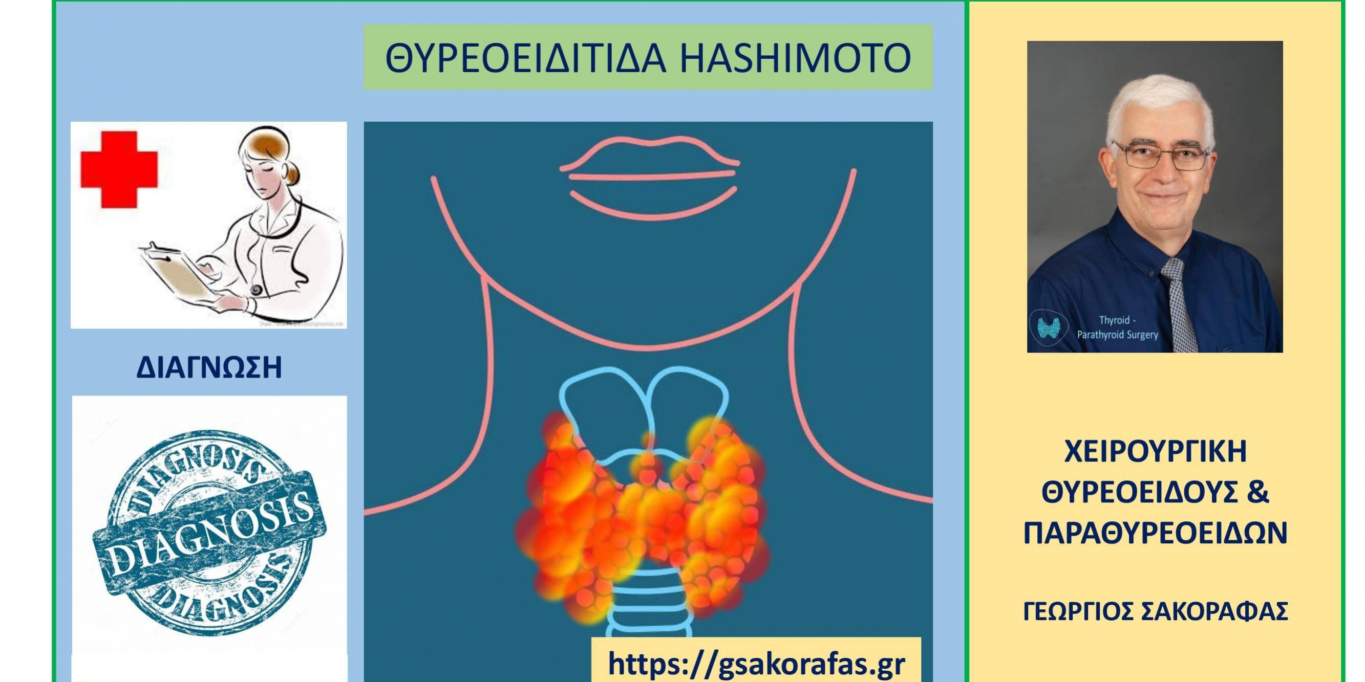 Θυρεοειδίτιδα Hashimoto και διάγνωση