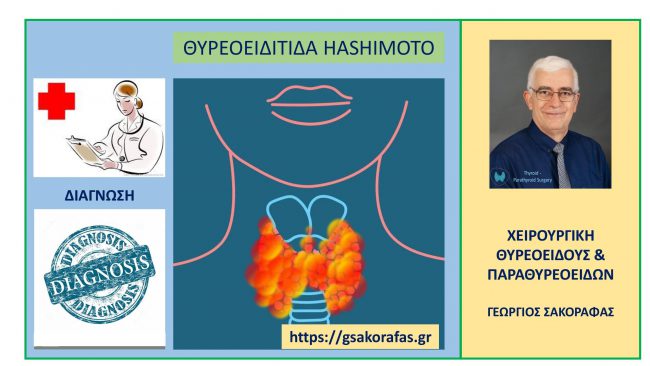 Θυρεοειδίτιδα Hashimoto και διάγνωση
