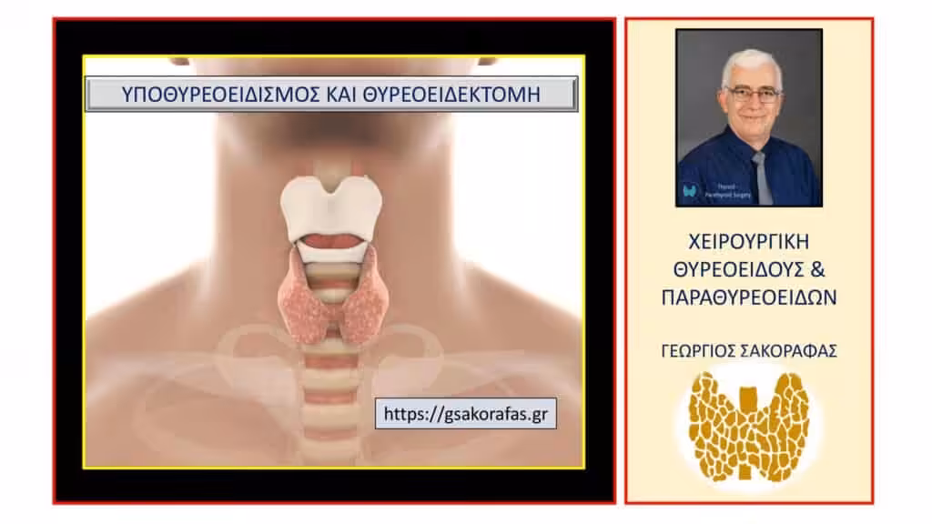 Υποθυρεοειδισμός – Μπορεί Να Χρειαστεί Χειρουργική Επέμβαση Και Πότε?
