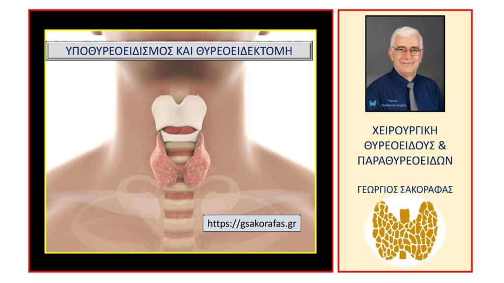 Υποθυρεοειδισμός – μπορεί να χρειαστεί χειρουργική επέμβαση και πότε? Υποθυρεοειδισμός – μπορεί να χρειαστεί χειρουργική επέμβαση και πότε?