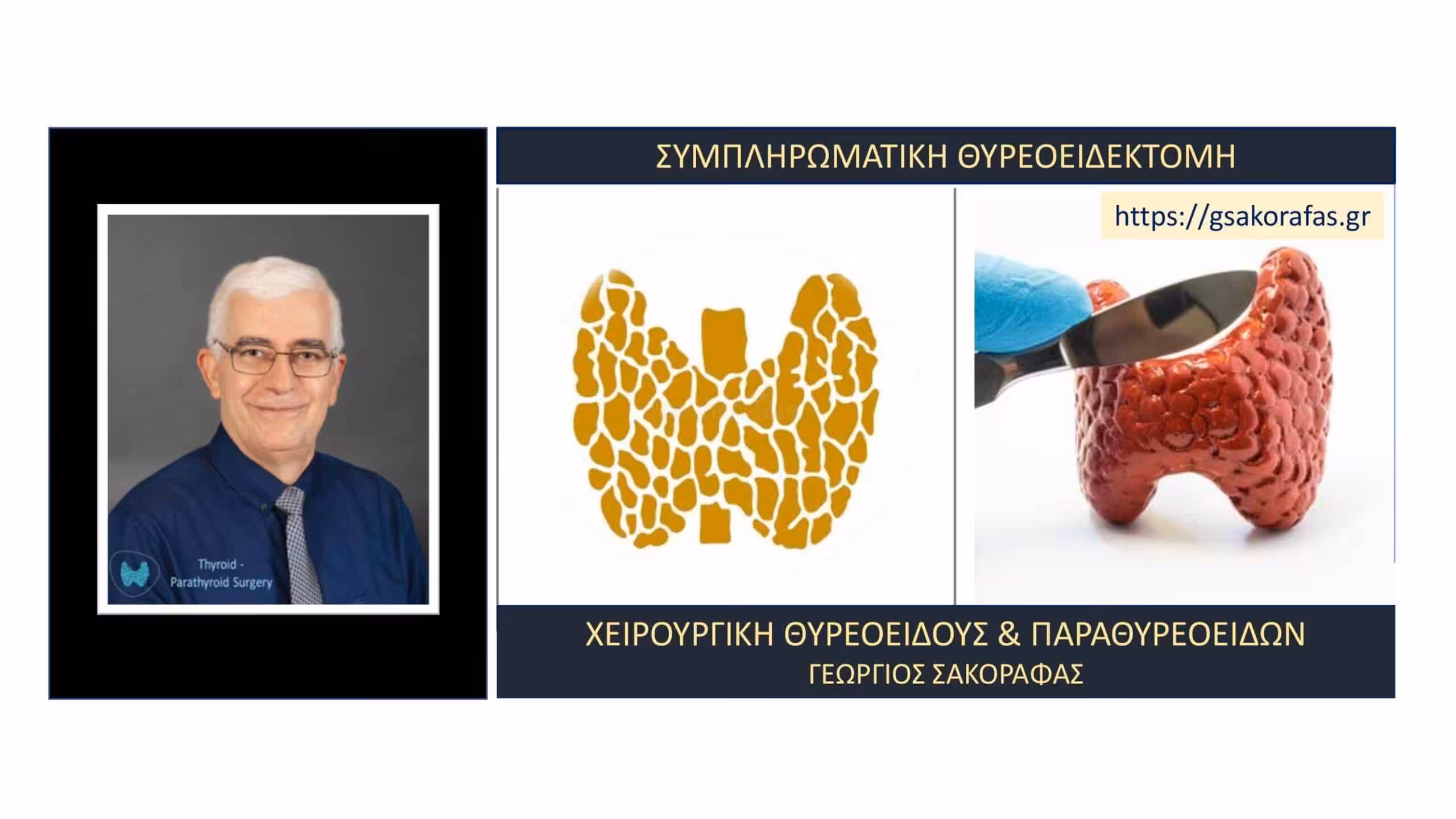 Συμπληρωματική θυρεοειδεκτομή (completion thyroidectomy)