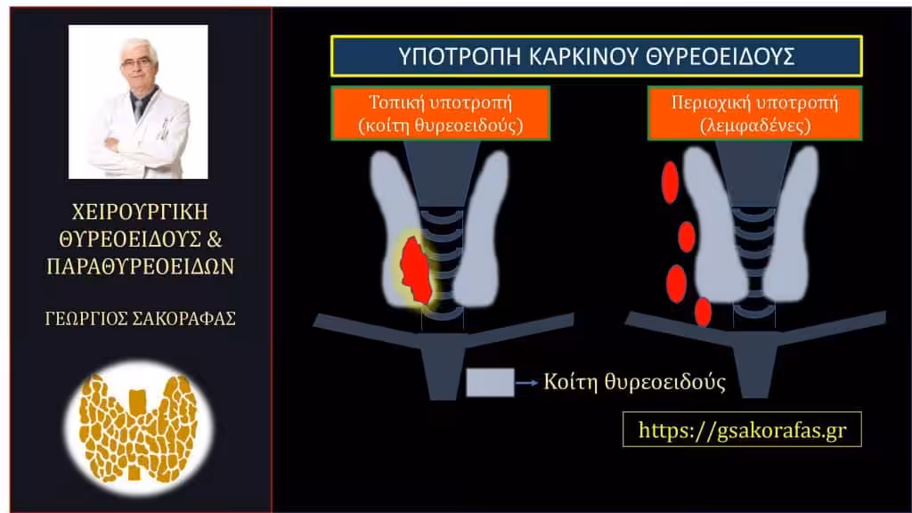 Καρκίνος Θυρεοειδούς - Υποτροπή Στον Τράχηλο Καρκίνος Θυρεοειδούς - Υποτροπή Στον Τράχηλο