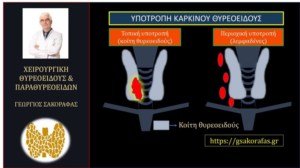 Καρκίνος θυρεοειδούς - υποτροπή στον τράχηλο