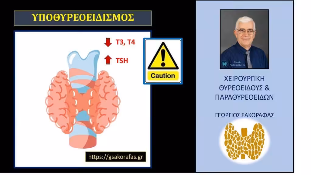 Υποθυρεοειδισμός Συμπτώματα Και Εκδηλώσεις